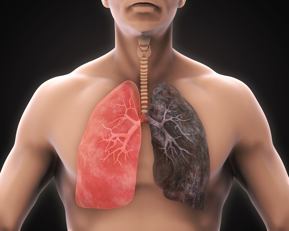 O que é o Check-UP Cardiopulmonar?