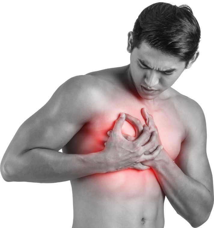 Infarto do Miocárdio