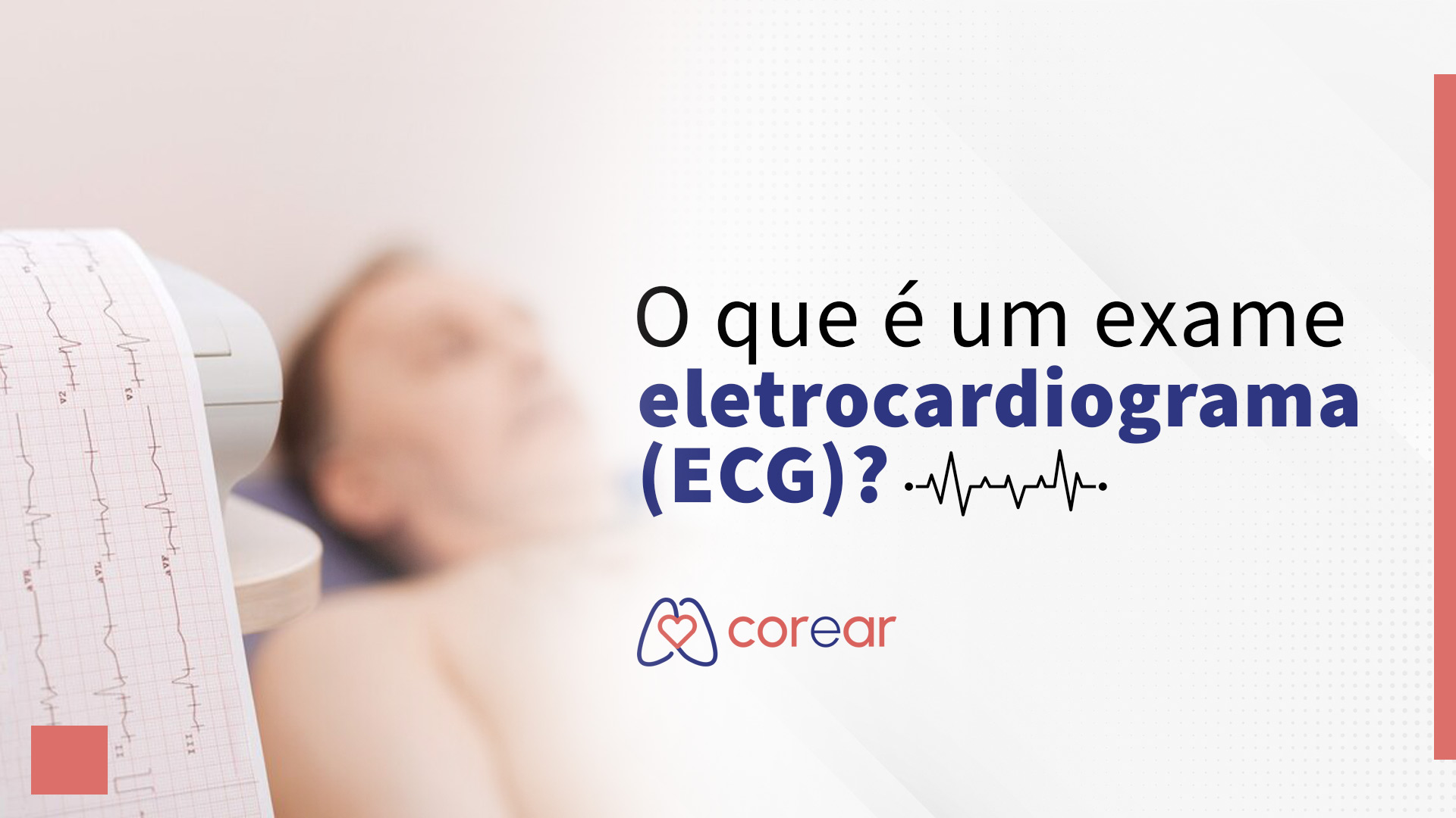  O que é um exame eletrocardiograma (ECG)?